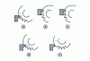 Figure 35 - Cutting-finishing cycle using the roller method