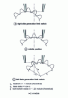 Figure 42 - Grinding with complete generation of a pair of flanks