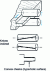 Figure 25 - Tenoning with unwinding tools: schematic diagrams