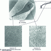 Figure 18 - Macrography and micrographs of the part shown in figure 16 [14].