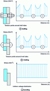 Figure 1 - Stress distribution