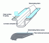 Figure 1 - Use of a delaminating fabric that can be peeled off at the time of peeling