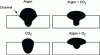 Figure 6 - Effect of shielding gas on penetration and bead shape in steel welding