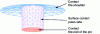 Figure 4 - Contact surface between tool and material [6].