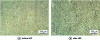 Figure 15 - Optical micrograph of a part manufactured by EBM before and after HIP