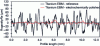 Figure 25 - Roughness profile before and after electro-polishing (Ti6Al4V EBM sample)