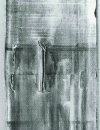 Figure 7 - Stress corrosion cracks in the inner wall of the transition zone of a tube (the extracted tube has been flattened to make the cracks more visible).