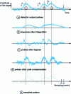 Figure 3 - Pulse shaping techniques