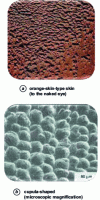 Figure 2 - Surface aspects of non-alloy steels affected by corrosion-erosion under single-phase flow
