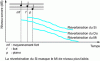 Figure 10 - Masking due to reverberation