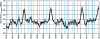 Figure 12 - Smoothing the noise curve