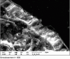 Figure 3 - Ettringite with expansive properties localized at the paste/granulate interface (scanning electron microscope)