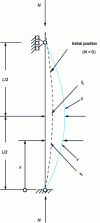 Figure 23 - Local imperfections