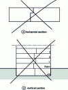 Figure 6 - Two types of bayonet joint to avoid (or even prohibit)