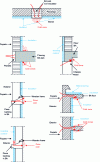 Figure 72 - Examples of thermal bridges