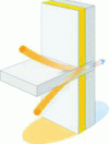 Figure 6 - Thermal bridge principle