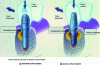 Figure 14 - Distributions of different compressive and tensile stresses in peri-implant bone for implants with threaded or porous surfaces and resulting from applied forces [93]