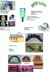 Figure 15 - Selective laser melting (SLM) of titanium for medical/dental parts [94]