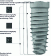 Figure 9 - Surface treatments on a 3iT3 tapered implant [86]