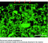 Figure 5 - X-ray microanalysis mapping of surface calcium in concrete exposed to weathering for six months