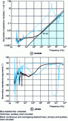 Figure 28 - Four impedances seen from the secondary of the 3-winding transformer