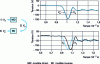 Figure 25 - Validation of the inverse model of the P6139A probe on a typical switching waveform