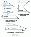 Figure 17 - Practical bevel termination solutions