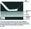 Figure 16 - Section showing a chip soldered to a DBC, with an aluminum bonding wire soldered to the top (doc. University of Nottingham).