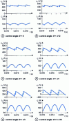 Figure 24 - Simulation of voltage vc and current i c on the DC side for various values of control angle  in rectifier operation.