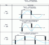 Figure 28 - Conditions on current frequency i1 to obtain ZVS mode