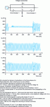 Figure 2 - An example of electromagnetic transients