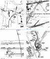 Figure 1 - Typical mapping examples used to identify distribution networks (Crédit Enédis)