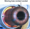 Figure 8 - Movable arc contact