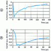 Figure 18 - Typical" waveform of the current pulse of the first return arc, on two time scales