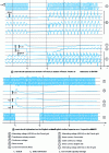 Figure 15 - Dynamic behavior of a DC link. Consequences of three-phase faults on the operation of the 2,000 MW France-England interconnection.