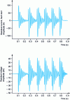 Figure 18 - Example of a re-priming fault