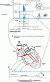 Figure 1 - Ventricular fibrillation (according to Dr Folliot)