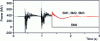 Figure 31 - Three-phase power ratings of the machines shown in figure . Simulation of a two-phase fault