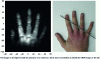 Figure 25 - NMR image (left) obtained by SQUID detection in a 100 µT field (after [81])