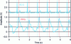 Figure 3 - Simultaneous measurement of PPG and ECG signals