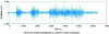 Figure 7 - Typical EMG signal