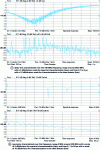 Figure 5 - Spectral and temporal responses of two elastic-wave transducer geometries