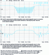 Figure 7 - Gain in isolation by time-division of the interrogation RF signal's transmission phase and reception phase.