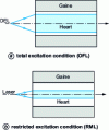 Figure 4 - Illustration of different light injection conditions in a FOM