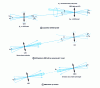 Figure 7 - Principle of the two-terminal acquisition method