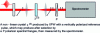 Figure 22 - Experimental set-up required for self-referencing spectral interferometry