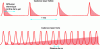 Figure 4 - Diagram of the cadence effect, which can lead to a gradual rise in temperature (thermal build-up).