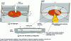 Figure 10 - Diagram of Joule-heated membranes for radiative emission