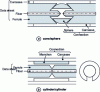 Figure 4 - Two ferrule connector alignment concepts