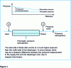 Figure 3 - Schematic illustration of the effect of pressure drop on transmembrane pressure in a crossflow filtration module.